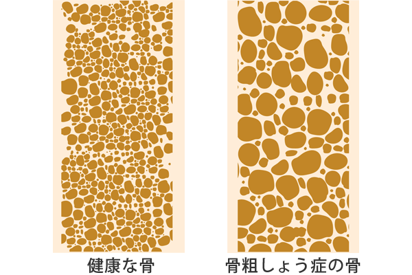 ���e���傤��