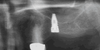 ��{���ɓ˂��o���Ă��܂����Ǘ�