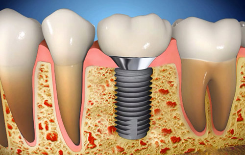 �l�H����