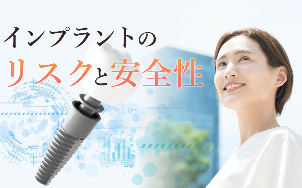 �C���v�����g�̃��X�N�ƈ��S��